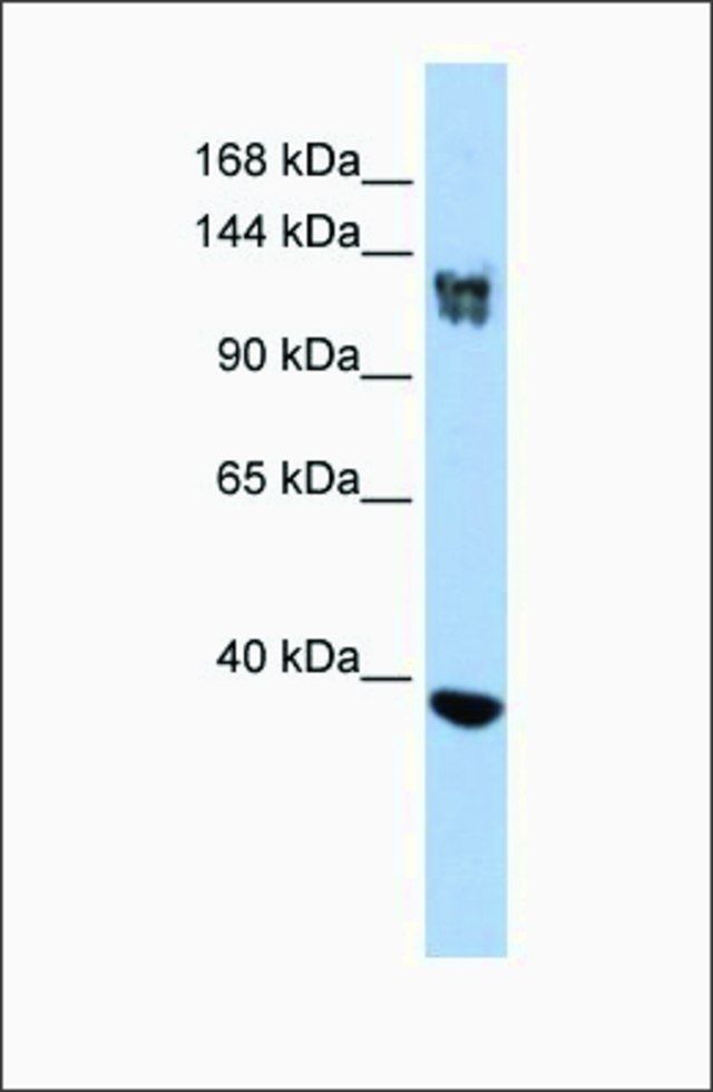 Anti-SMARCA1 (ab3) antibody produced in rabbit