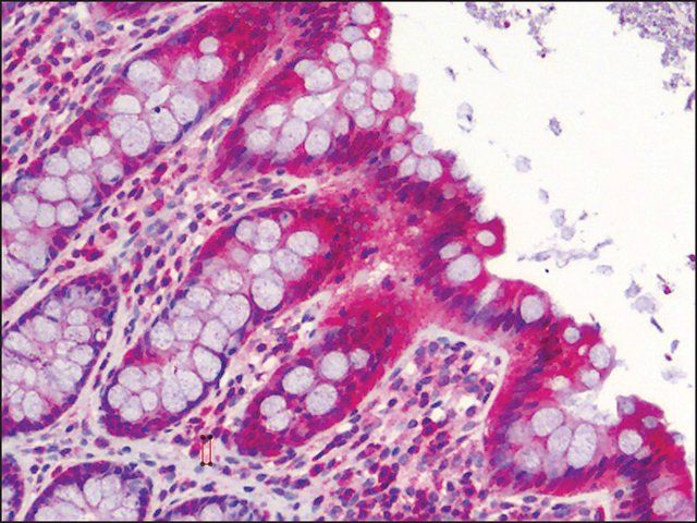 Anti-SLFN12 antibody produced in rabbit