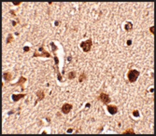 Anti-SLITRK4 antibody produced in rabbit