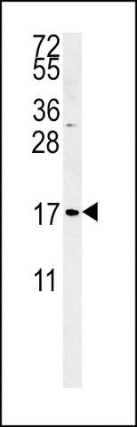 ANTI-SMAGP (CENTER) antibody produced in rabbit