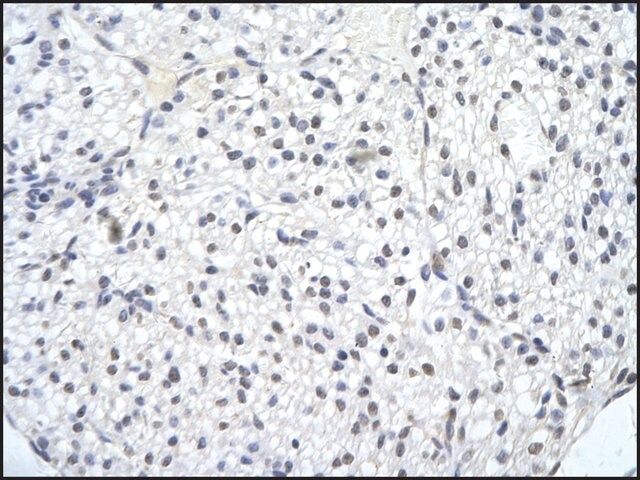 Anti-SMARCA1 (ab2) antibody produced in rabbit