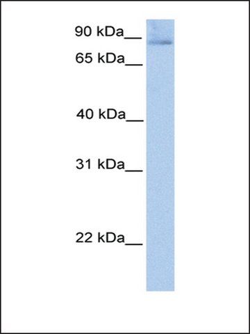 Anti-SLITRK1 antibody produced in rabbit