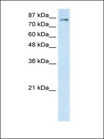 Anti-SMARCA3 (AB2) antibody produced in rabbit