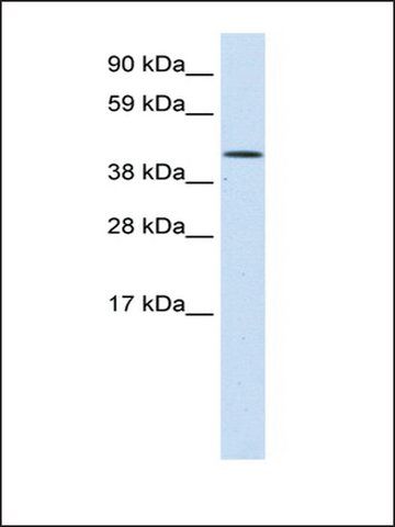 Anti-SMARCA1 antibody produced in rabbit