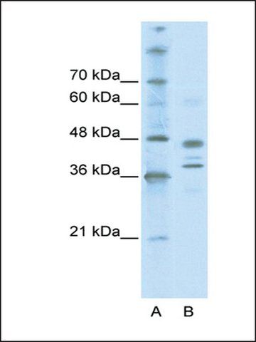 Anti-SMARCB1 (AB2) antibody produced in rabbit