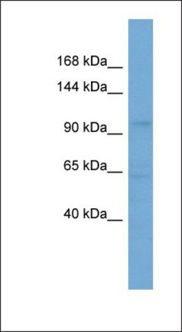 Anti-SLCO5A1 antibody produced in rabbit