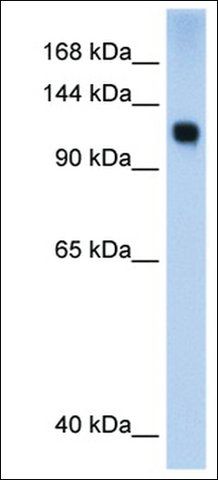 Anti-SMARCA5 (AB2) antibody produced in rabbit