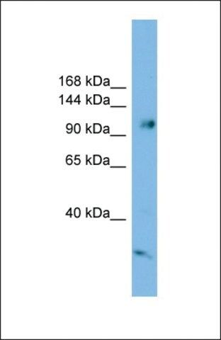 Anti-SMEK1 antibody produced in rabbit