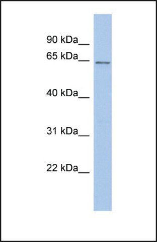 Anti-SMARCD2 antibody produced in rabbit