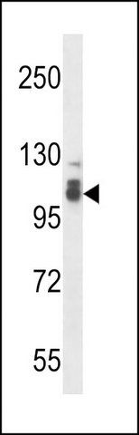 ANTI-SMEK2 (C-TERM) antibody produced in rabbit