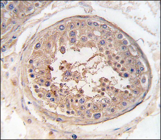 Anti-SPAG9 (center) antibody produced in rabbit