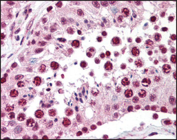 Anti-SPANXC (AB1) antibody produced in rabbit