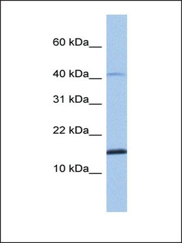 Anti-SPAG11B antibody produced in rabbit