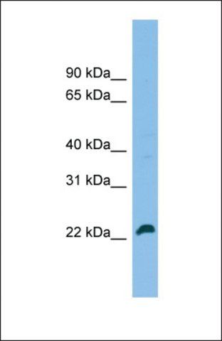 Anti-SPATA24 , (C-terminal) antibody produced in rabbit