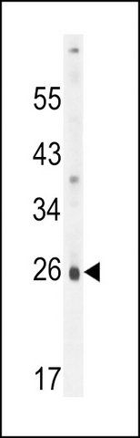 ANTI-PQLC1 (CENTER) antibody produced in rabbit