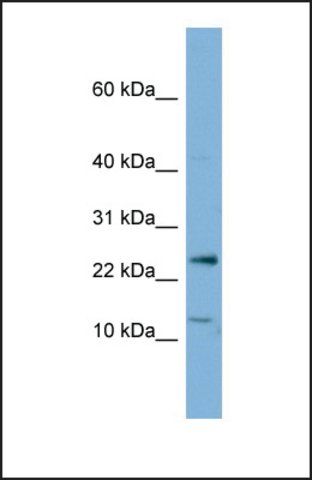 Anti-PPP1R11, (N-terminal) antibody produced in rabbit