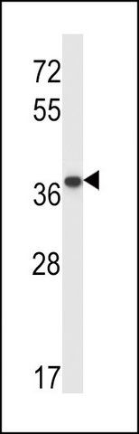 ANTI-PPP2CB (C-TERM) antibody produced in rabbit