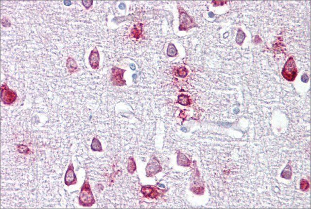 Anti-PPME1, (N-terminal) antibody produced in rabbit