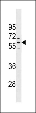 ANTI-PRAMEF1(C-TERMINAL) antibody produced in rabbit