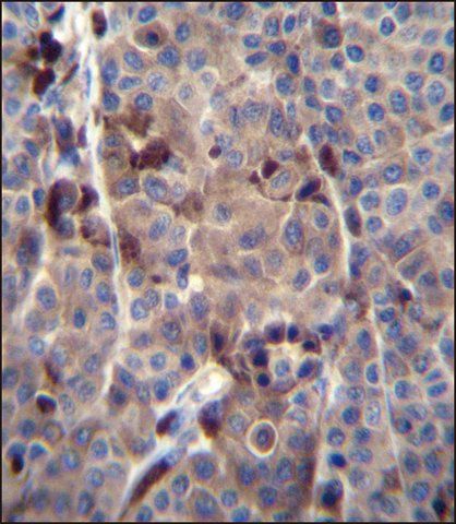 ANTI-PRAMEF8 (C-TERM) antibody produced in rabbit