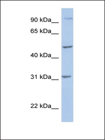 Anti-PPM1J antibody produced in rabbit