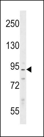 ANTI-PPP1R9B(N-TERMINAL) antibody produced in rabbit