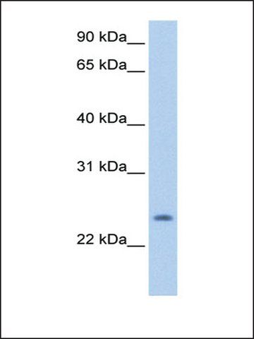 Anti-PQLC1 antibody produced in rabbit