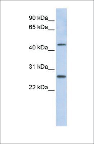 Anti-PRAMEF10 antibody produced in rabbit