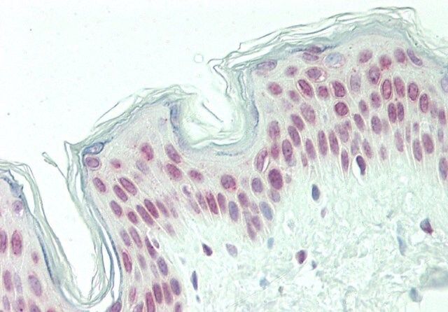 Anti-PQBP1 antibody produced in rabbit