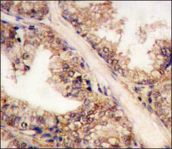 Anti-PRMT4 (C-term) antibody produced in rabbit