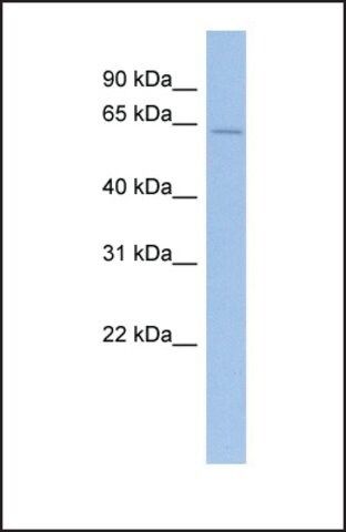 Anti-PRDM11 antibody produced in rabbit