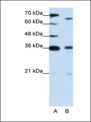 Anti-PRDM13 antibody produced in rabbit