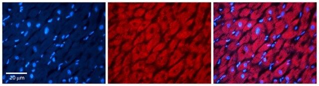 Anti-PRKACA, (N-terminal) antibody produced in rabbit