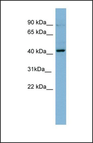 Anti-PRKCB1, (N-terminal) antibody produced in rabbit