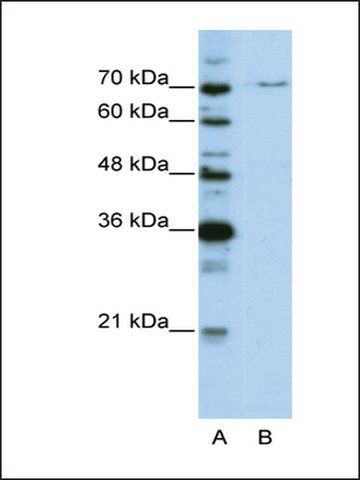 Anti-PRPF3 antibody produced in rabbit