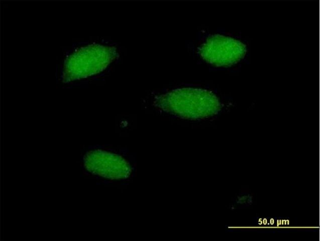 Anti-PRKRIR antibody produced in mouse