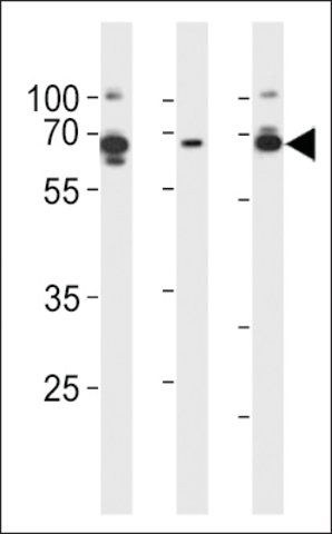 ANTI-PRKAG3(C-TERMINAL) antibody produced in rabbit