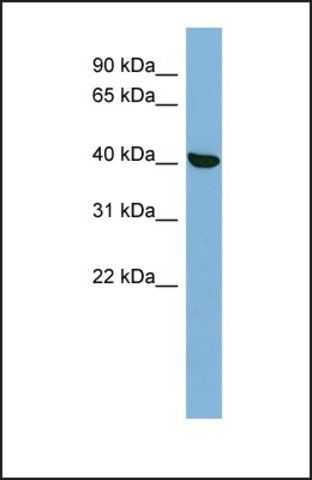 Anti-PRKX, (N-terminal) antibody produced in rabbit