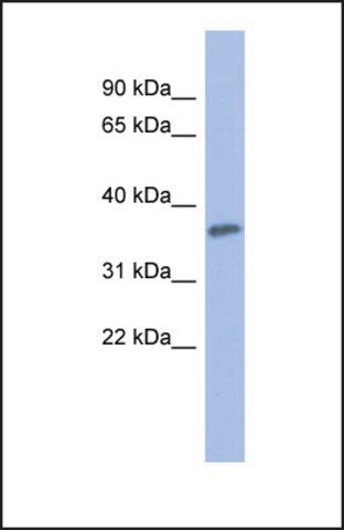 Anti-PRKCG antibody produced in rabbit