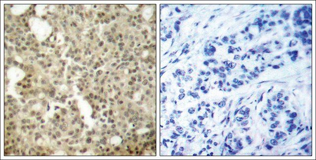 Anti-PRKCD (Ab-645) antibody produced in rabbit