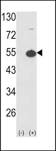 ANTI-PROTEIN KINASE A REGULATORY SUBUNIT I ALPHA(N-TERMINAL) antibody produced in rabbit