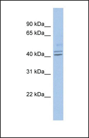 Anti-PROCA1 antibody produced in rabbit