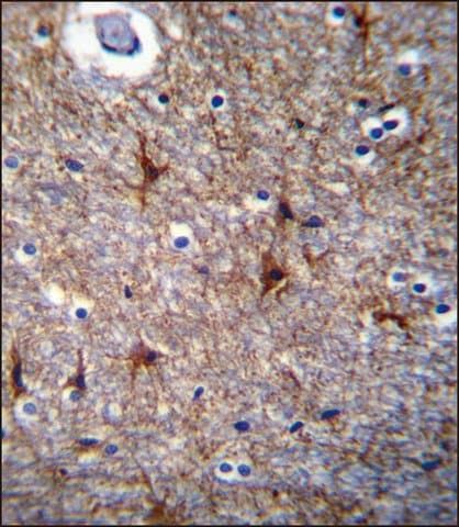 ANTI-PRR16 (C-TERM) antibody produced in rabbit