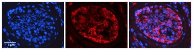 Anti-PRKCZ antibody produced in rabbit