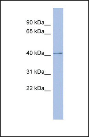 Anti-PRKAR1B antibody produced in rabbit