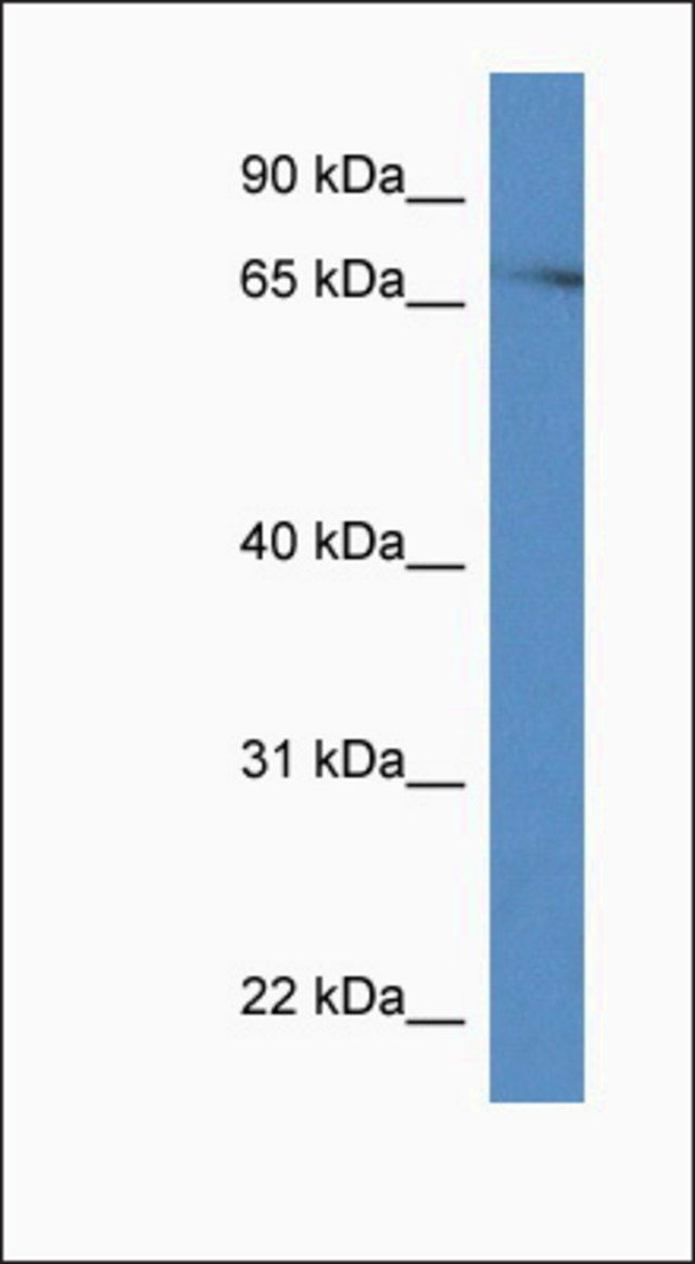 Anti-PRKCH antibody produced in rabbit