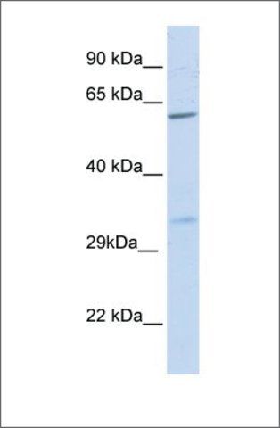 Anti-PRPS2 antibody produced in rabbit