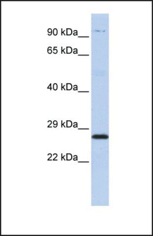 Anti-PSMB4 antibody produced in rabbit