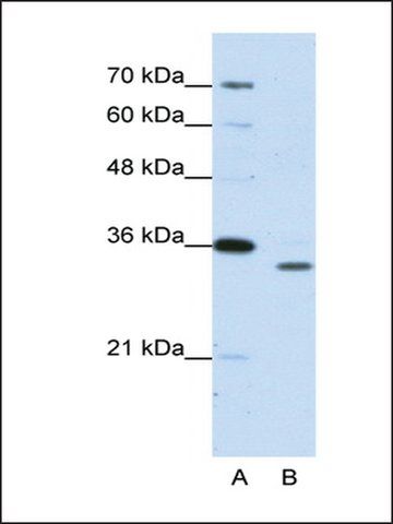 Anti-PSMA1 antibody produced in rabbit