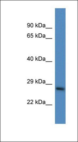 Anti-PSMD10 antibody produced in rabbit